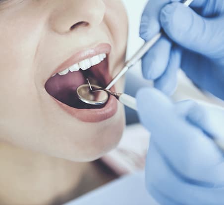 Hygiene & Exams | York Lanes Dental | North York, Toronto